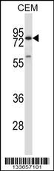 MMP16 Antibody (C-term)