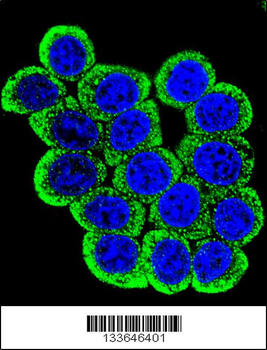 MMP13 Antibody (Center)