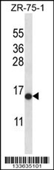 HIST2H2AB Antibody (N-term)