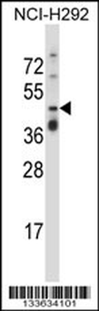 TNFRSF10A Antibody (C-term)