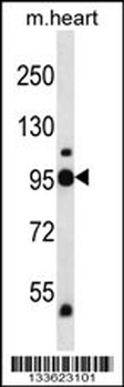 PYGB Antibody (N-term)