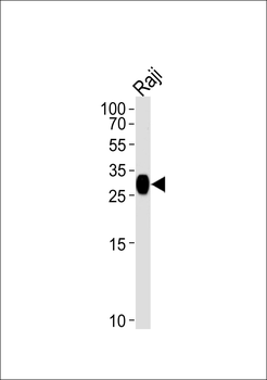 HLA-DRB4 Antibody (N-term)
