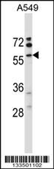 VNN3 Antibody (C-term)