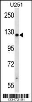 TTC13 Antibody (N-term)