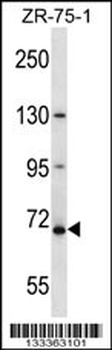 ZNF135 Antibody (N-term )