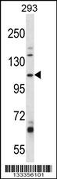 B4GALNT3 Antibody (Center)