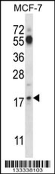 SSSCA1 Antibody (N-term )
