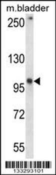 GRID1 Antibody (C-term)