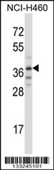 TRIM31 Antibody (C-term)