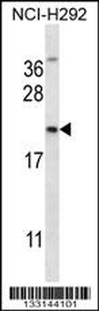 MUC1/EMA Antibody (C-term)