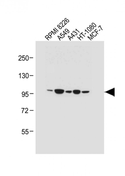 RHBDF2 Antibody (N-term)