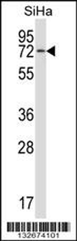 HSPA12B Antibody (N-term)