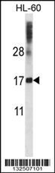 DNAL4 Antibody (N-term)