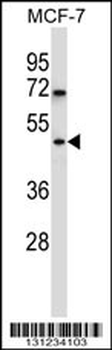 WDR88 Antibody (C-term)