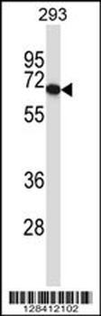 PDILT Antibody (Center)