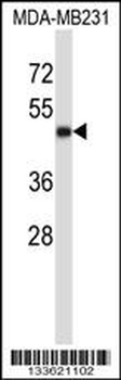 CD1A Antibody (Center)