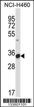 FCGR3A Antibody (C-term)