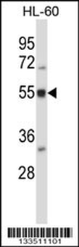 BAIAP2L2 Antibody (N-term)