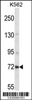 ZNF132 Antibody (N-term)