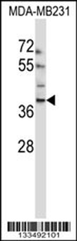 EMID1 Antibody (N-term)