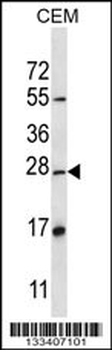 D4S234E Antibody (N-term)