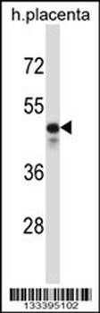 KCNS2 Antibody (N-term)