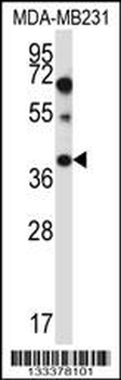 PTPLA Antibody (N-term)