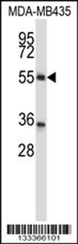 ZNF222 Antibody (N-term )