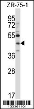 NEUROD6 Antibody (N-term )