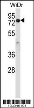 CCDC22 Antibody (C-term)