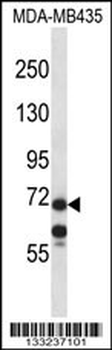 MID1 Antibody (C-term)