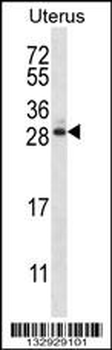ARL8A Antibody (Center)