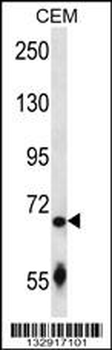 SLC27A3 Antibody (N-term)