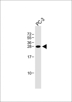 NDFIP1 Antibody (Center)