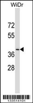 DUOXA2 Antibody (C-term)