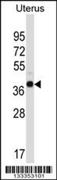 WDR89 Antibody (C-term)