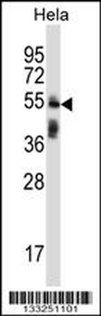 TRIM38 Antibody (C-term)