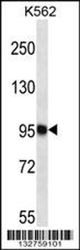 TTC15 Antibody (C-term)