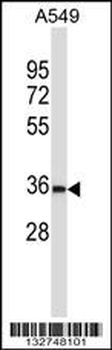 BEAN Antibody (N-term)