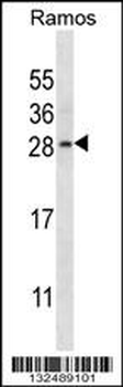 RAB21 Antibody (C-term)