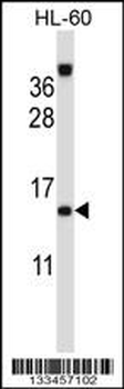 ROBLD3 Antibody (Center)