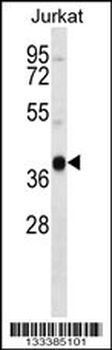 MARCH4 Antibody (C-term)