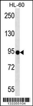 ZNF227 Antibody (N-term )