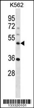 NLE1 Antibody (C-term)