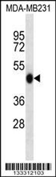 WIPI2 Antibody (N-term)