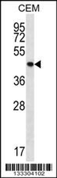 PTPN2 Antibody (C-term)