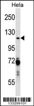 PARP1 Antibody (N-term)