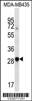 CXCR6 Antibody (N-term)
