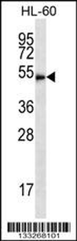 HDAC3 Antibody (C-term)