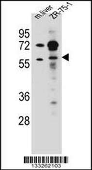TRIM62 Antibody (C-term)